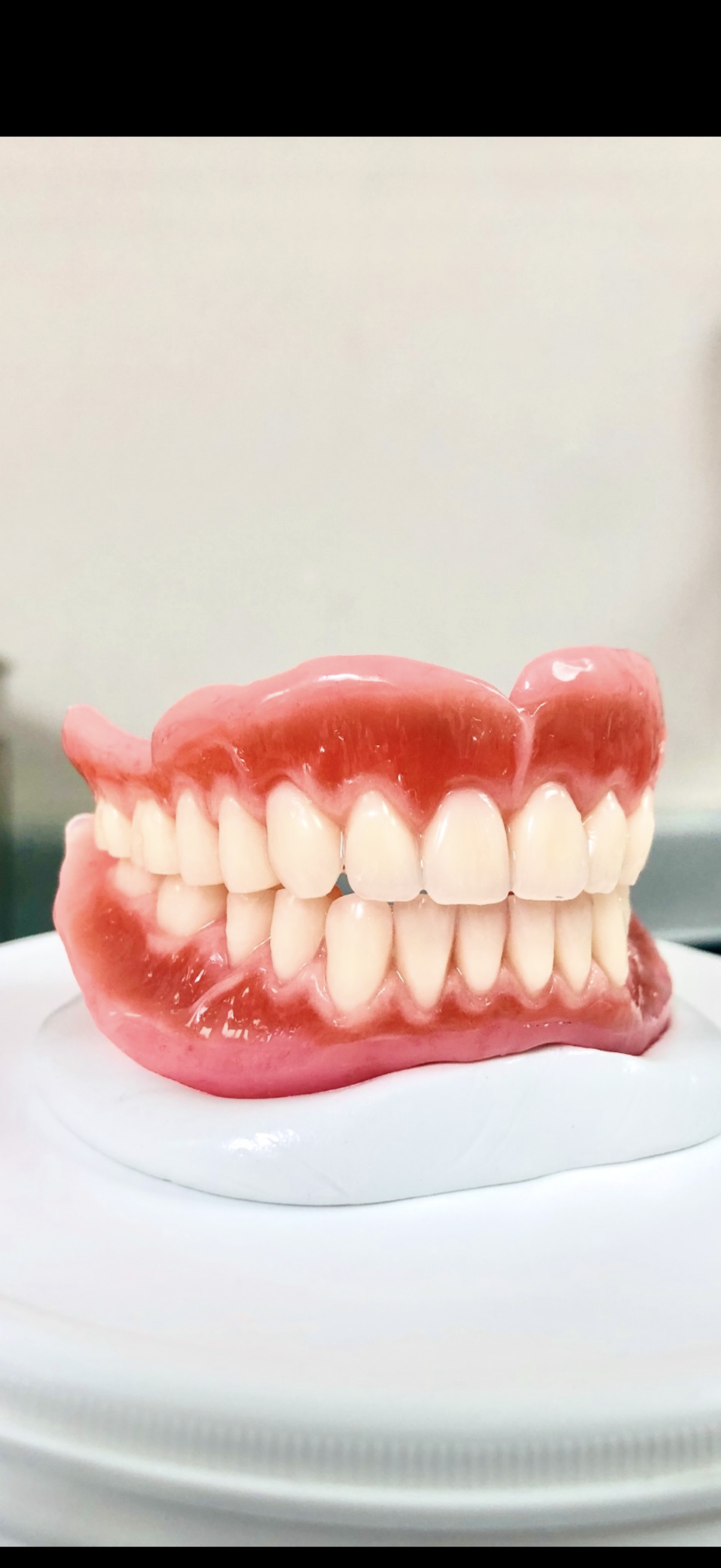 Complete Dentures