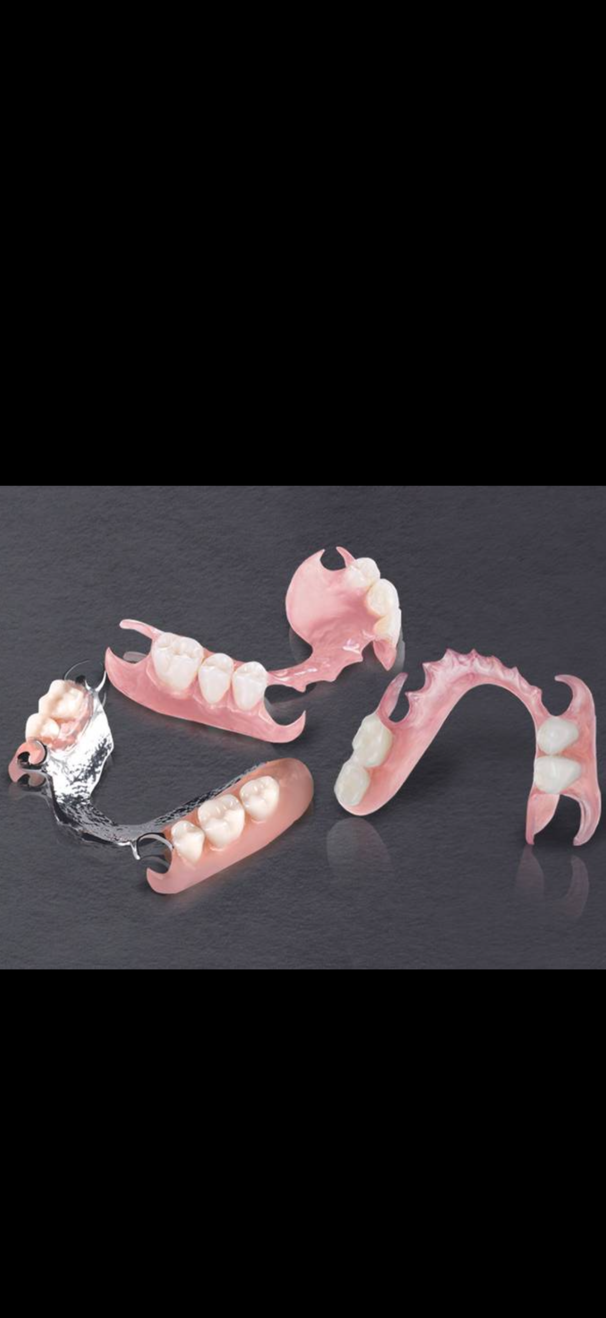 Partial Dentures