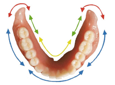 Lower suction dentures available in Victoria